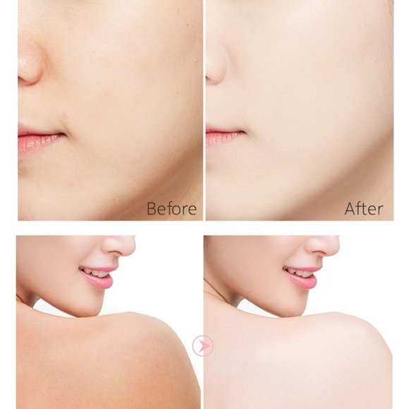 Dark Spot Corrector Serum Removal - Picture 8 of 9